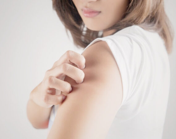Dermatitis Herpetiforme y celiaquía
