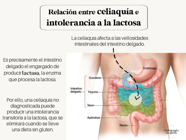 La relación entre la celiaquía y la intolerancia a la lactosa