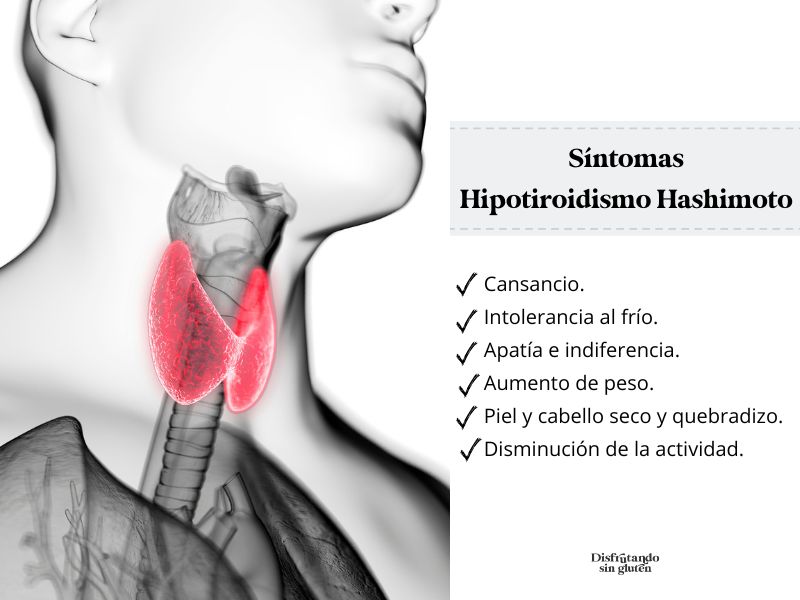 Síntomas Hipotiroidimo Hashimoto