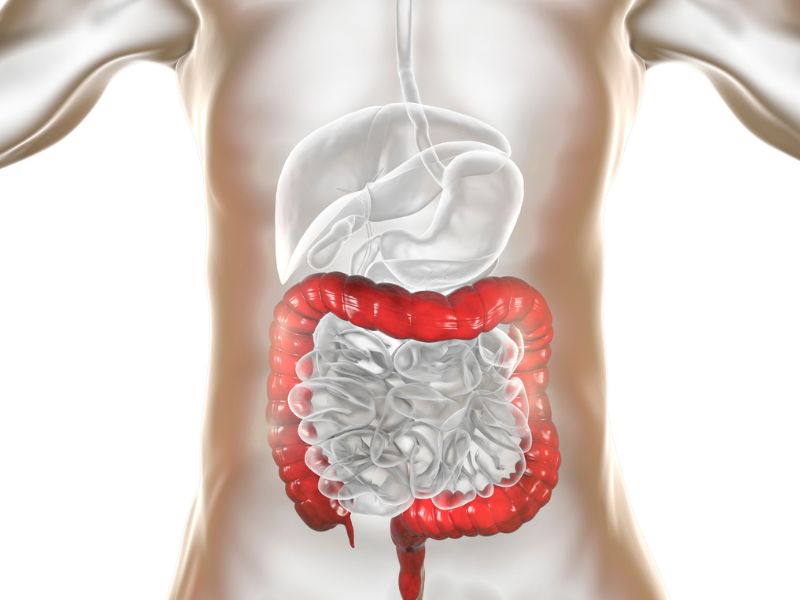 Sobrecrecimiento bacteriano (SIBO) mi experiencia