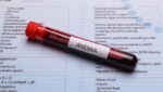 Relación entre la celiaquía y la anemia ferropenica.
